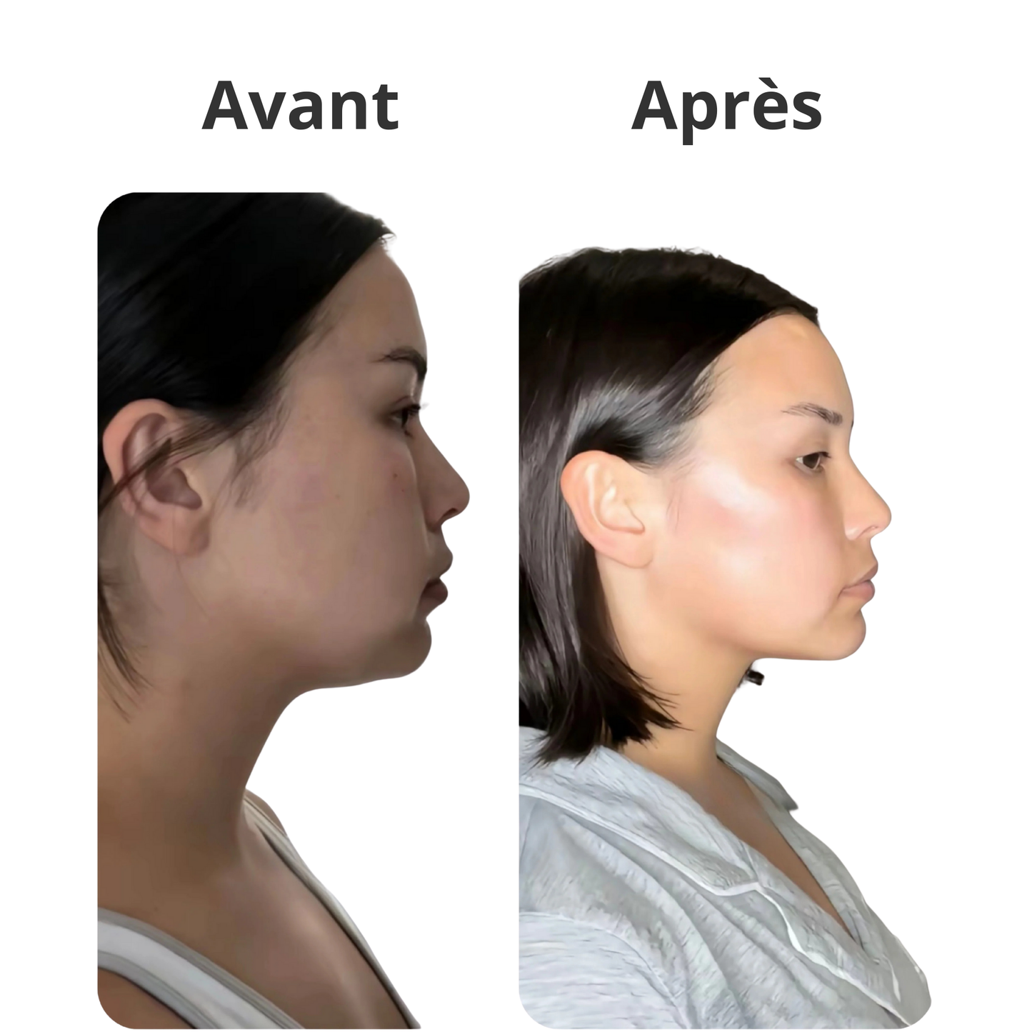 Gaine Faciale Amincissante